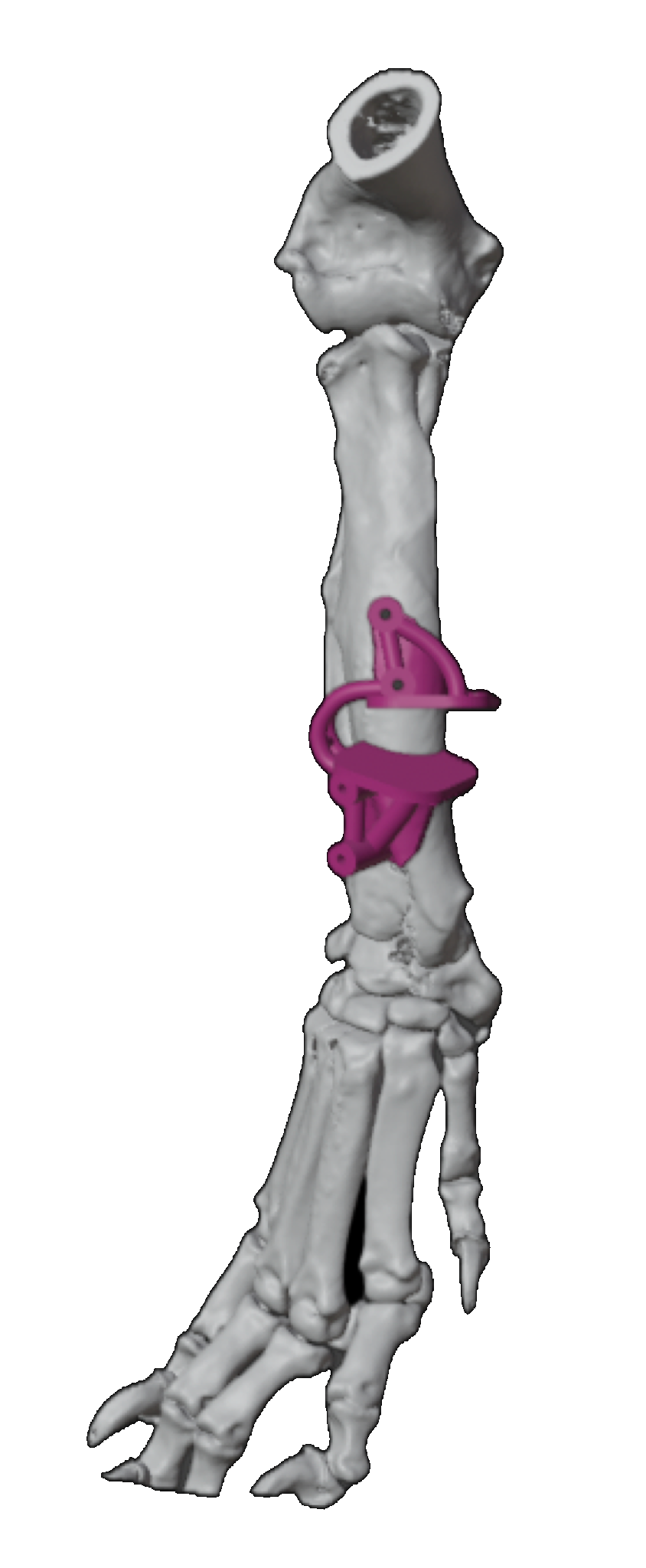 Canine forelimb with a patient-specific osteotomy guide
